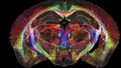 اسکن مغز با دقتی بیسابقه