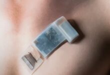 انقلاب در کنترل سلامت